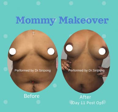 Slider image (4) Dr. Siripong Plastic Surgery in Thailand